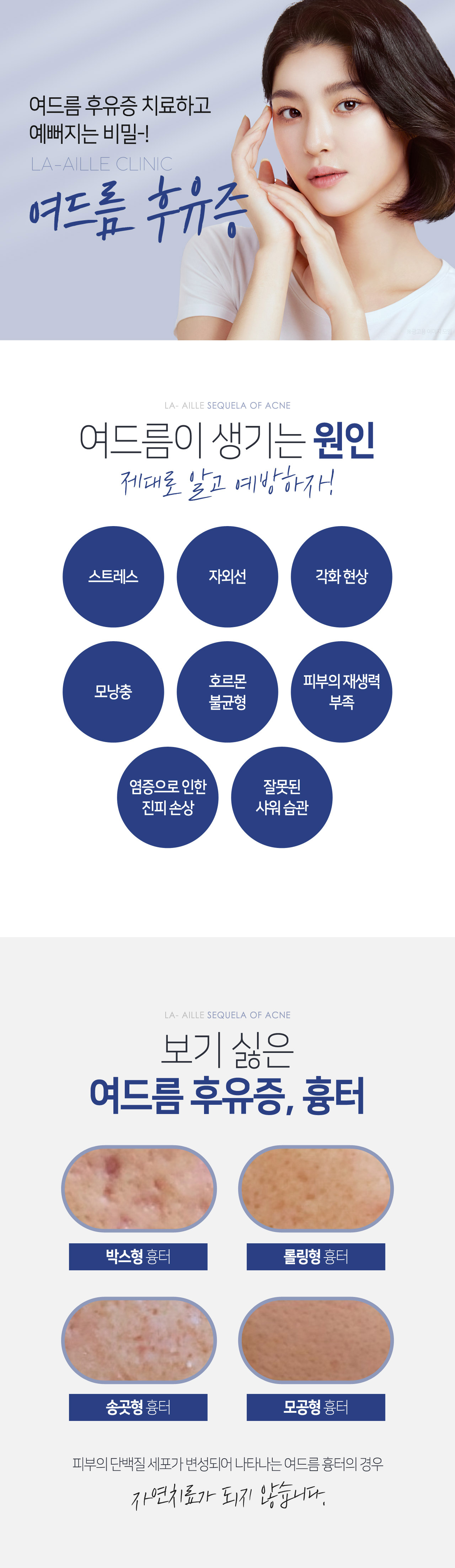 여드름 후유증